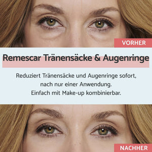 Remescare Tränensäcke & Augenringe